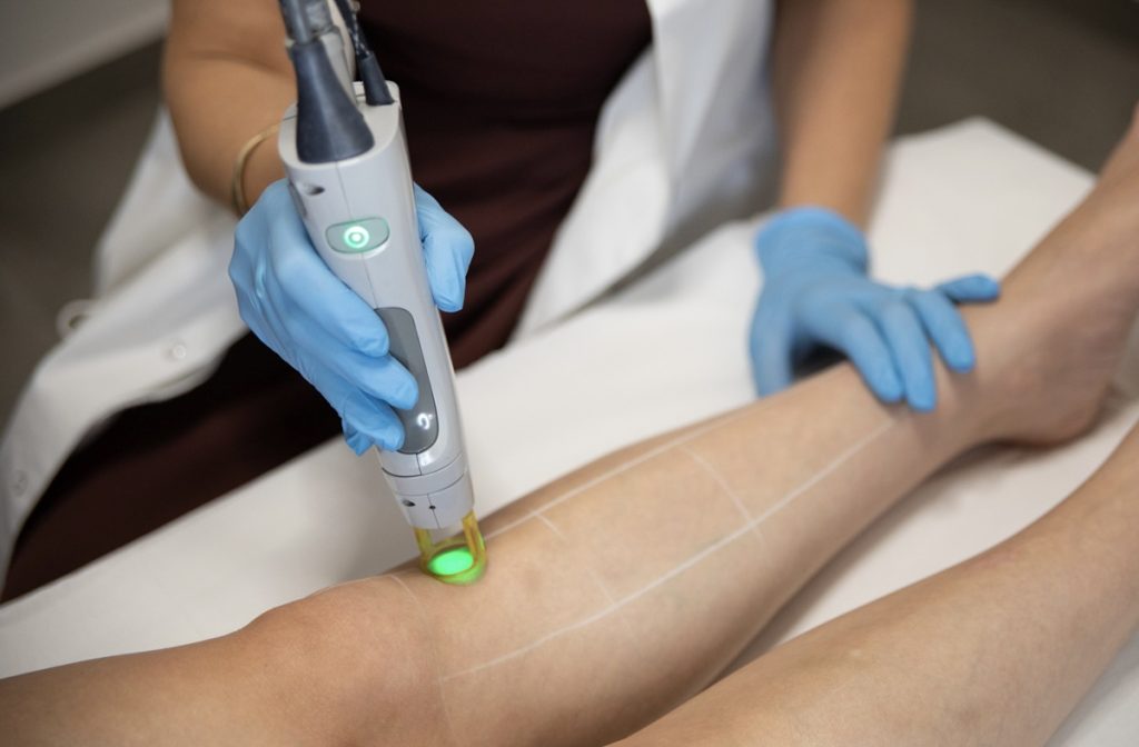 αποτρίχωση laser καλλιθέα 2