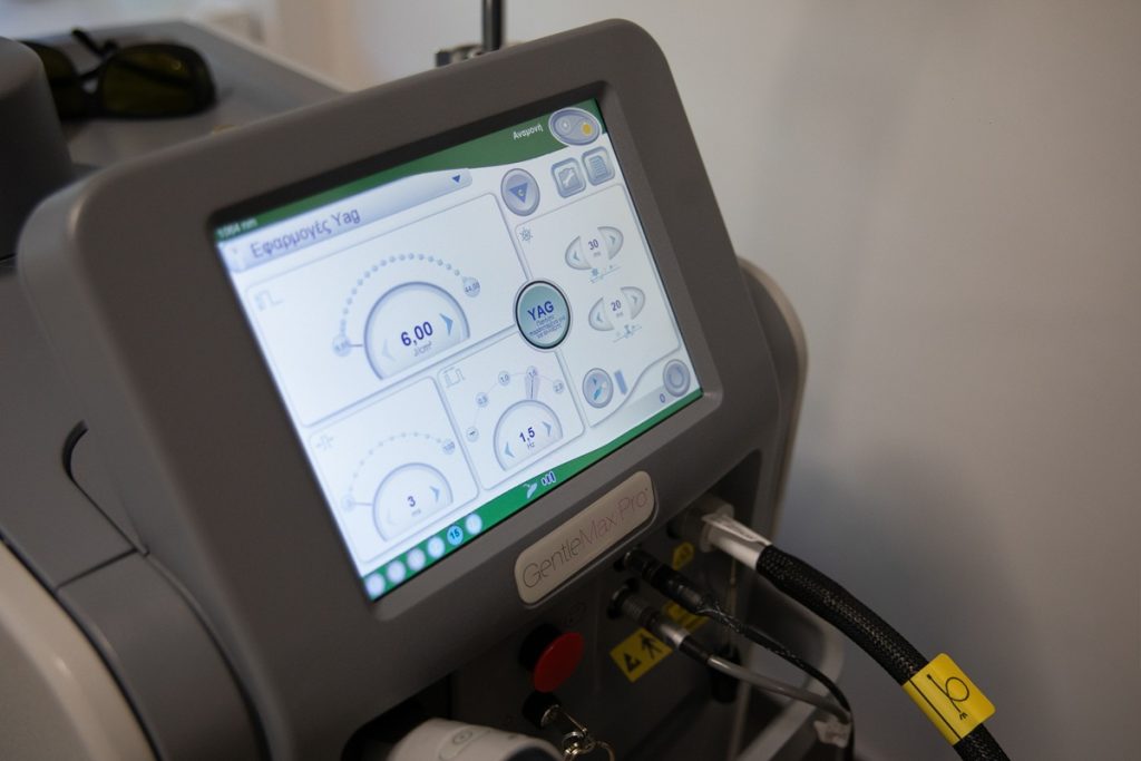 αποτρίχωση laser καλλιθέα 4